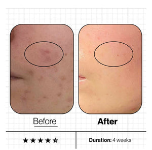Advanced Nutrition Programme Skin Clear Biome 10 day supply