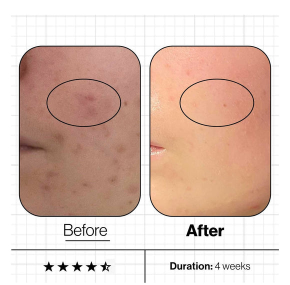 Advanced Nutrition Programme Skin Clear Biome 10 day supply