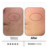 Advanced Nutrition Programme Skin Clear Biome 10 day supply