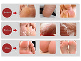BEAUTYPRO Foot & Callus Peel Treatment 40g